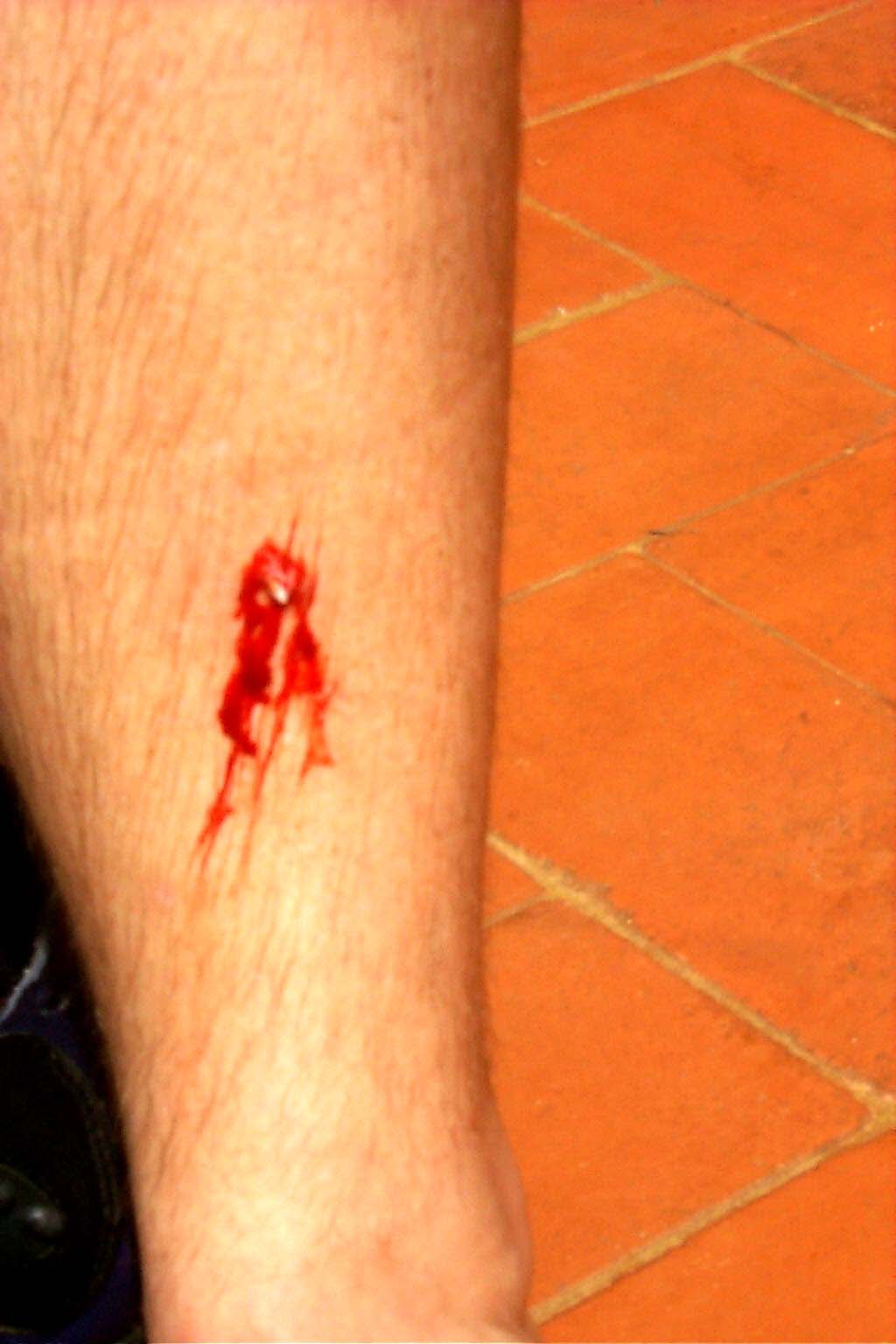 CR99_Wound2.jpg (85445 bytes)